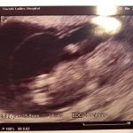 妊娠３ヶ月　初めての妊婦検診