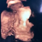 妊娠7ヶ月後半の妊婦健診
